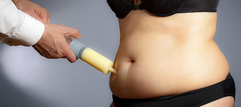 Liposuction Surgery in Chandigarh