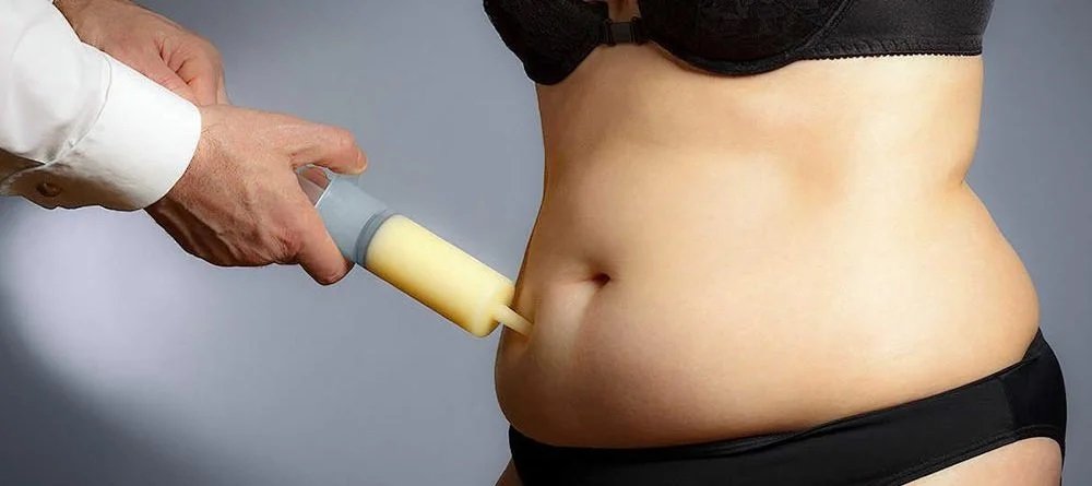 You are currently viewing 5 Things To Know Before Getting Liposuction