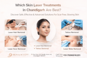 Read more about the article Which Skin Laser Treatments In Chandigarh Are Best for Glowing, Scar-Free Skin?